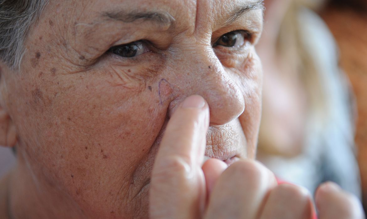 brasileiros-devem-redobrar-cuidados-no-verao-contra-cancer-de-pele